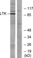 LTK Polyclonal Antibody