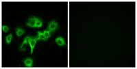 CDO Polyclonal Antibody