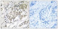 CDYL2 Polyclonal Antibody