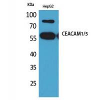 CEACAM1/5 Polyclonal Antibody