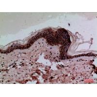 CEACAM1/5 Polyclonal Antibody