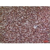 CEACAM1/5 Polyclonal Antibody