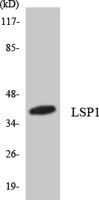 LSP1 Polyclonal Antibody