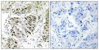 CENP-A Polyclonal Antibody