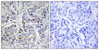 CENP-A Polyclonal Antibody
