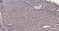 CENPF Polyclonal Antibody