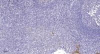 Lsk Polyclonal Antibody