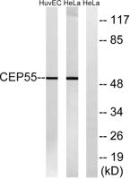 CEP55 Polyclonal Antibody