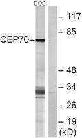 CEP70 Polyclonal Antibody