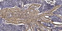 CEP76 Polyclonal Antibody