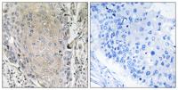 Cerebellin 3 Polyclonal Antibody