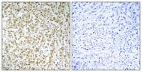 CERKL Polyclonal Antibody