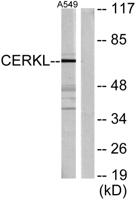 CERKL Polyclonal Antibody