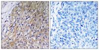 GOLT1A Polyclonal Antibody
