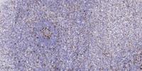 ROS1 Polyclonal Antibody