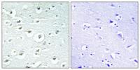 RoXaN Polyclonal Antibody