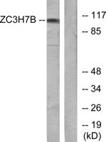 RoXaN Polyclonal Antibody