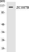 RoXaN Polyclonal Antibody