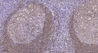 RPA135 Polyclonal Antibody
