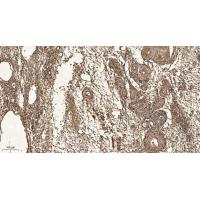 RPA14 Polyclonal Antibody