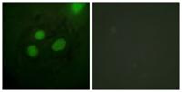 RPA32 Polyclonal Antibody