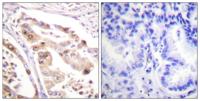 RPA32 Polyclonal Antibody
