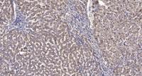 CES2 Polyclonal Antibody