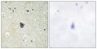 c-Fms Polyclonal Antibody