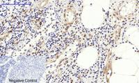 c-Fos Polyclonal Antibody