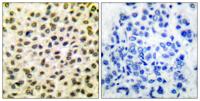 c-Fos Polyclonal Antibody