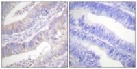 CFTR Polyclonal Antibody