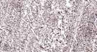 CGGBP1 Polyclonal Antibody