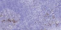 cGKII Polyclonal Antibody