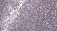 cGKII Polyclonal Antibody