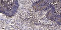 LRRK2 Polyclonal Antibody