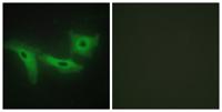 LRRK1 Polyclonal Antibody