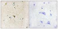 LRRK1 Polyclonal Antibody