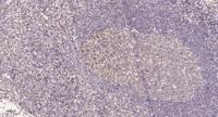 LRRC41 Polyclonal Antibody