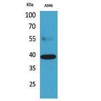 CGR19 Polyclonal Antibody