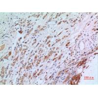 CGREF1 Polyclonal Antibody