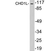 CHD1L Polyclonal Antibody
