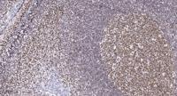 CHD6 Polyclonal Antibody