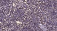 CHD8 Polyclonal Antibody