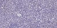 CHD9 Polyclonal Antibody