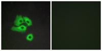 Chemokine Receptor D6 Polyclonal Antibody