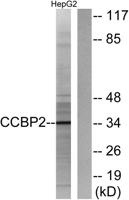 Chemokine Receptor D6 Polyclonal Antibody