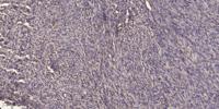 Chemokine Receptor D6 Polyclonal Antibody