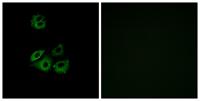 Chemokine Receptor D6 Polyclonal Antibody