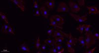 ChemR23 Polyclonal Antibody
