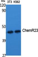 ChemR23 Polyclonal Antibody